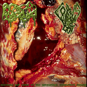 Necrosis and Lysis of the Myocardial Connective Tissue
