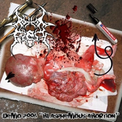 The Blasphemous Abortion