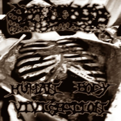 Human Body Vivisection