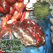 Paraphimosis / Perforated Bowel Syndrome With Oozing Faeces