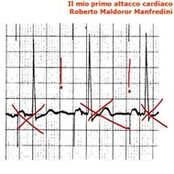 Il mio primo attacco cardiaco