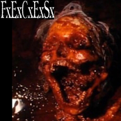 Vibrio Parahaemolyticus