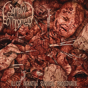 Illicit Infantile Surgical Procedures