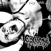 Open Up And Say Ahh...