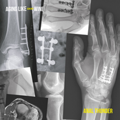 Aging Like (Cheap) Wine