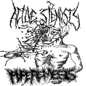 Active Stenosis / Hyperemesis