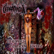 Extirpación Visceral