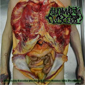 Pulverizando Entranhas Pútridas De Cadáveres Violados E Meio Decompostos