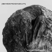 Lithopedion