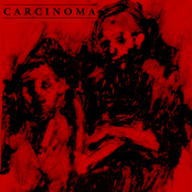 Carcinoma