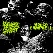 BruceXCampbell/Pyogenic Cystclot