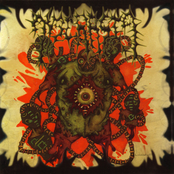 Septical Stomach - Pumped Remnants