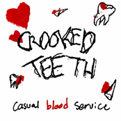 Crooked Teeth