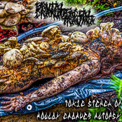 Toxic Stench Of Mouldy Cadaver Autopsy