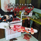 Postmortem Procedures by Exhumed