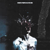 severance