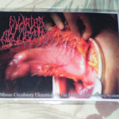 4 Minute Circulatory Ulceration Of The Female Reproductive System