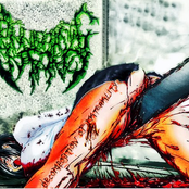 Decomposition Of Materiality EP