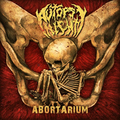 Abortarium