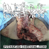 Putrefied Urethral Junk