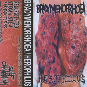 Bradymenorrhoea / Herophilus