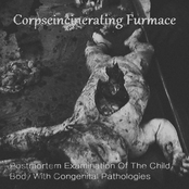 Postmortem Examination Of The Child Body With Congenital Pathologies