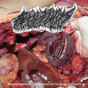 Gastroenterological Paradoxical Surgical Influence