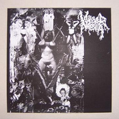 csmd / vulgar nausea