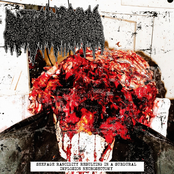Seepage Rancidity Resulting In A Subdural Implosion Necrosectomy