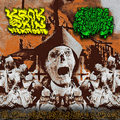 To Hell With Residential Schools