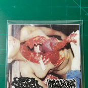 Gored Stomach Contents / Hydrocephalus