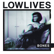 Bones