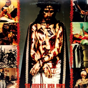 The Society's Open Hurts