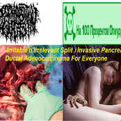 Irritable'n'Irrelevant Split / Invasive Pancreatic Ductal Adenocarcinoma For Everyone