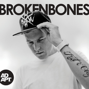 Broken Bones EP