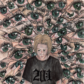20:1