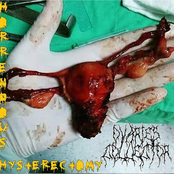 Horrendous Hysterectomy
