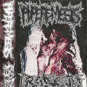 Hyperemesis / Rancid Flesh