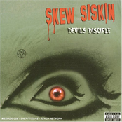 Genocide by Skew Siskin