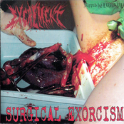 Excrement (mex) - Hipermenorrea (mex)