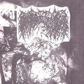 Death Due To Uterine Rupture