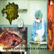Forensic Scalpel Pathology Of A Human Scum