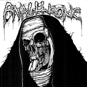 Analthrone / Black Putrefaction