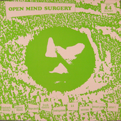 Open Mind Surgery