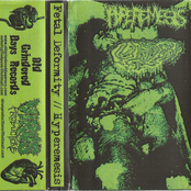 Hyperemesis / Fetal Deformity