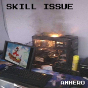 skill issue