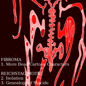 Fibroma & Reichstag Motel - Split