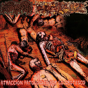 Atraccion Patologica por lo Grotesco