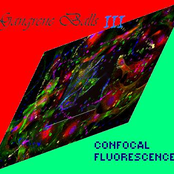 Gangrene Balls III: Confocal Fluorescence