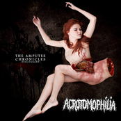 The Amputee Chronicles